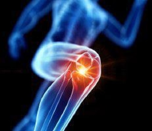 Meniscus Tear & Cartilage Defects