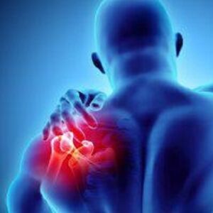Rotator Cuff Tear